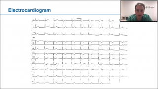 Clinical Case Studies Presenting as Acute Coronary Syndrome