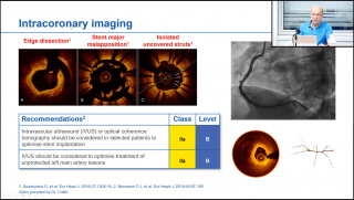 Image from webinar on Devices in the Cath Lab