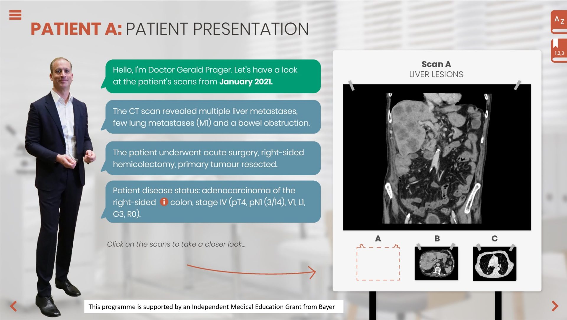 Long-term Management of Advanced CRC: An Interactive Patient Case