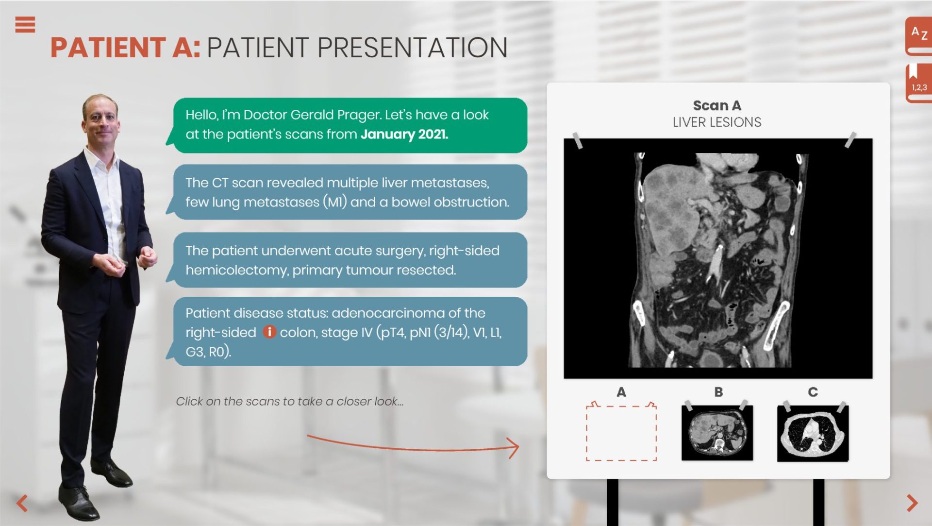 long-term-management-of-advanced-crc-patient-case